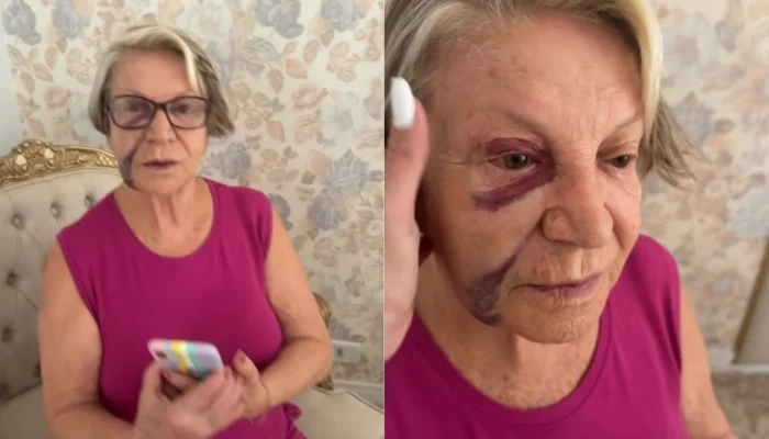 Poliana Rocha atualiza estado de saúde da mãe, Eponina, 84 anos, após queda que deixou roxos visíveis: "Um dia após o outro"