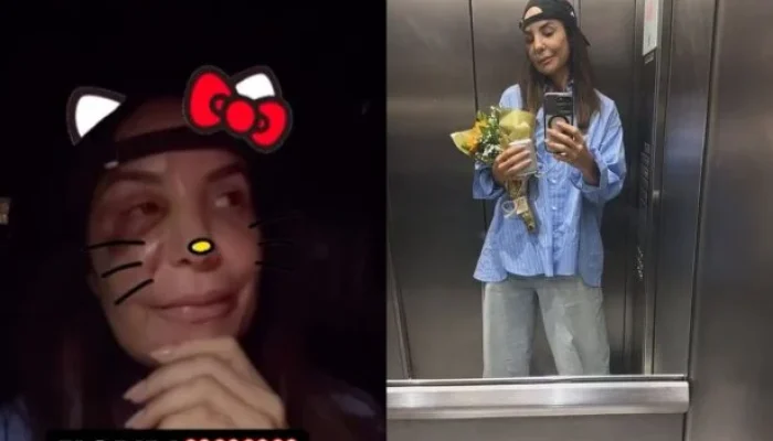 Ivete Sangalo recebe alta após cirurgia facial e já planeja turnê: "Fogo no projeto Clareou!"