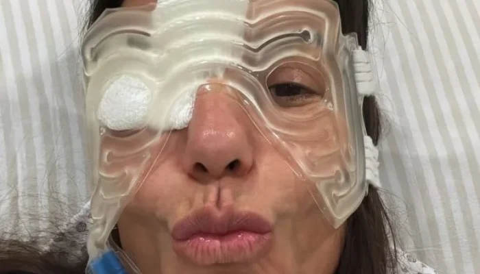 Ivete Sangalo surge com 'cabeça de gelo' após cirurgia no rosto e tranquiliza fãs com bom humor