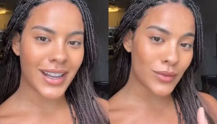 Bella Campos choca web ao mostrar cicatriz de mordida de jacaré após gravações de Pantanal no Mato Grosso do Sul