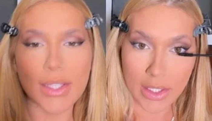 Virginia Fonseca revela: hormônios para engravidar causaram espinhas e manchas, mas influenciadora garante tratamento da pele