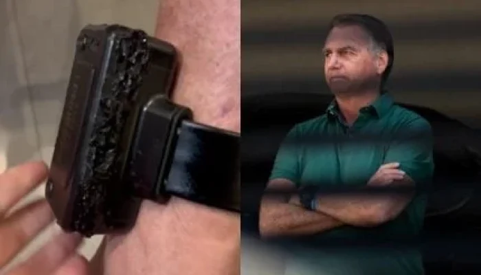 Tornozeleira Eletrônica de Bolsonaro: Vídeo Revela Estado Danificado Após Tentativa de Violação com Ferro de Solda