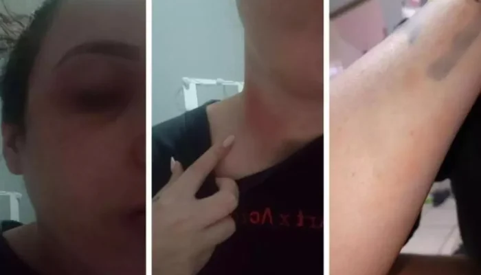 Cantor de Pagode Acusado de Agressões Brutais Contra Ex e Idoso na Baixada Santista: Reincidência e Medida Protetiva Revogada