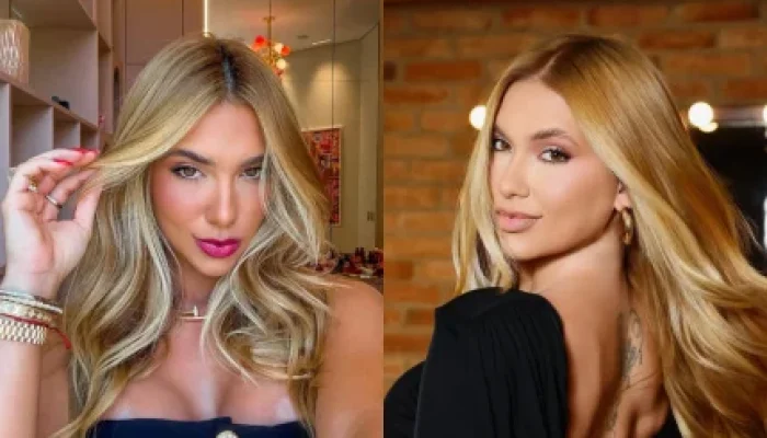 Virginia Fonseca em SP: Laser de CO₂, Subcisão e Exossomos Vegetais para Tratar Cicatrizes de Acne e Renovar a Pele