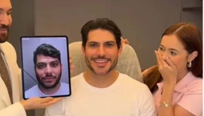 Mirela Janis Revela "Antes e Depois" da Harmonização Facial de Yugnir Ângelo e Deixa Seguidores em Choque com Brincadeira sobre a Transformação