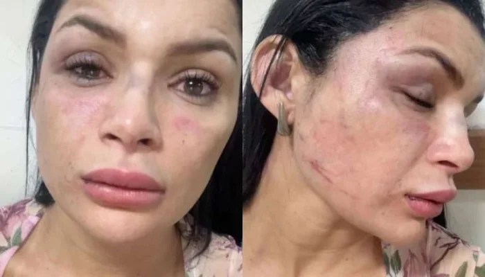 Musa de escola de samba é espancada em Manaus durante corrida de aplicativo; vídeo choca